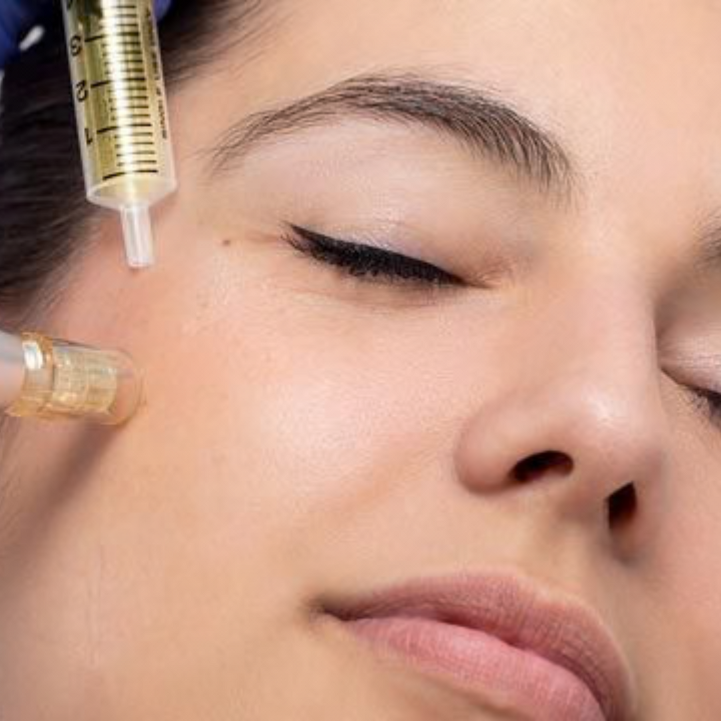MESOTERAPIA CON VITAMINAS