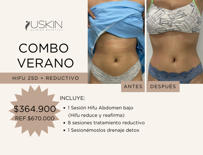 COMBO VERANO: REDUCTIVO INTENSIVO + HIFU 25D