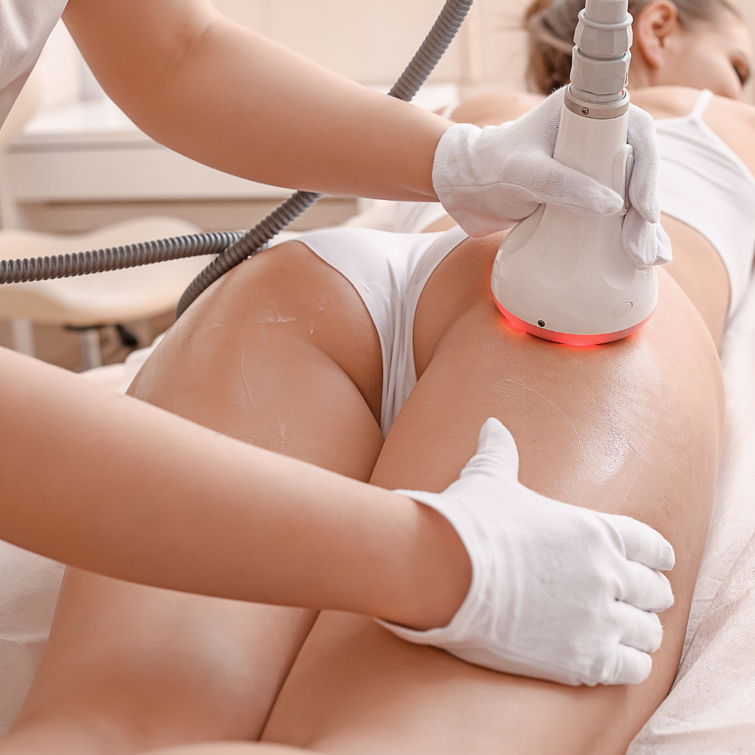 Tratamiento Anticelulitis (seis sesiones)