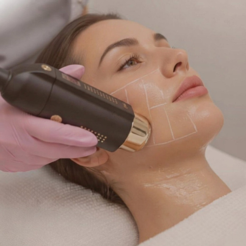 HIFU 25D ROSTRO COMPLETO Y PAPADA ¡OFERTA PREVENTA!