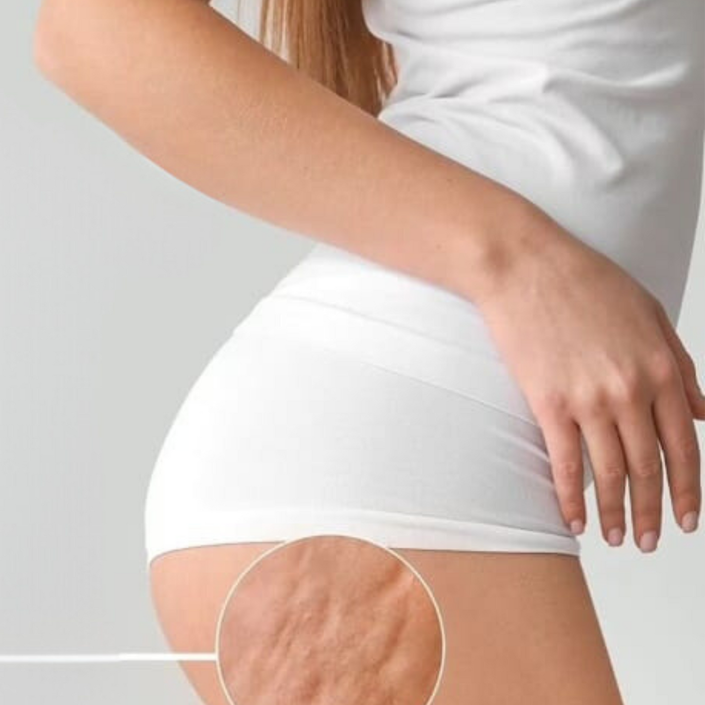 ANTICELULITIS 8 SESIONES